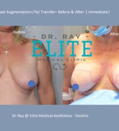 Dr Ray – Elite Medical Aesthetics