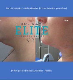 Dr Ray – Elite Medical Aesthetics